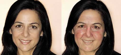 What just TWO glasses of wine a day can do to your face in ten years photo