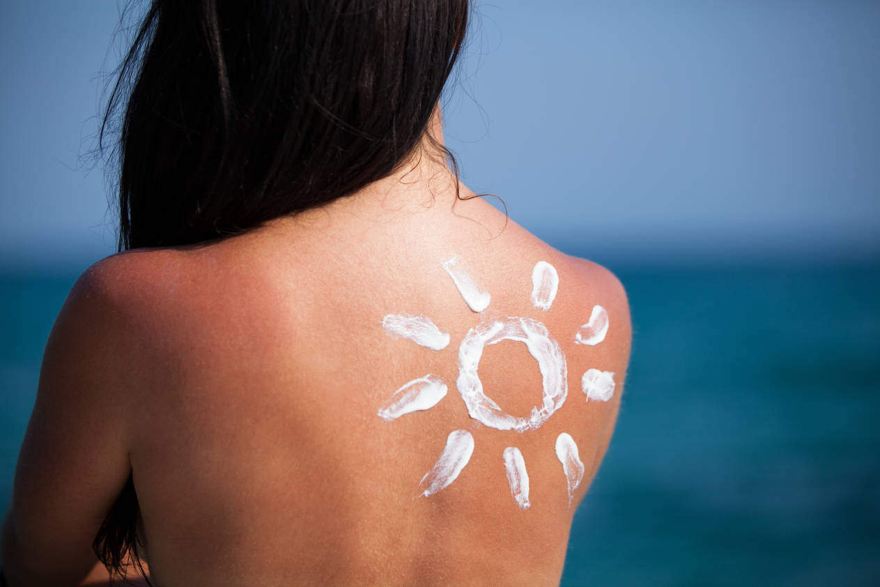Sunburn Treatment Options From Your Own Pantry photo